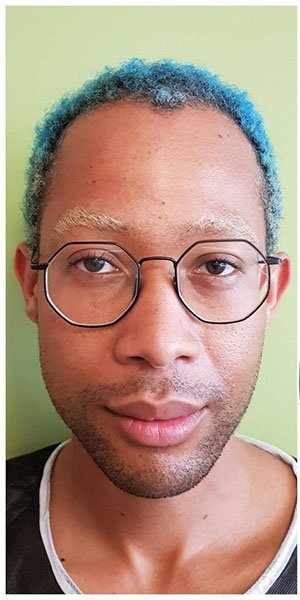 Before treatment